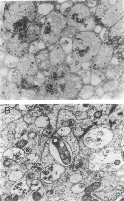 Ultrastructure Of Nodule Formed By Mu225 On G Max Cv Williams A