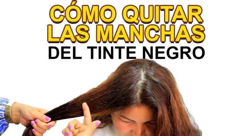 Con qué se quita el tinte negro de la piel