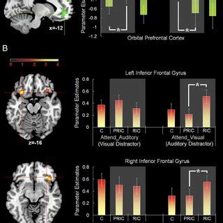 Neural Correlates Underlying The Visual And Auditory Dominance At