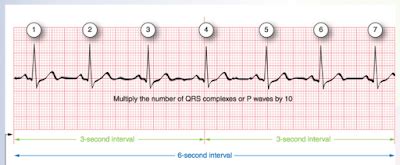 Traumagency: Count Irregular Rhythm HEART Rate