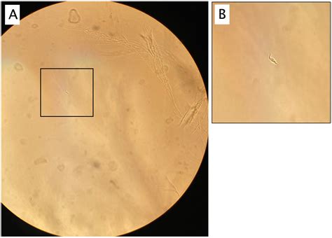 Trypanosoma cruzi parasite - Entomology Today