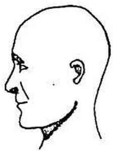 Mesocephalic and Mesocephaly - MedFriendly.com