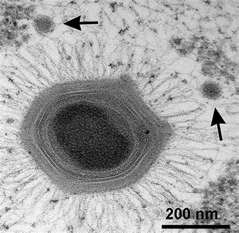 Using Dna To Trace The Origins Of Giant Viruses Astrobiology