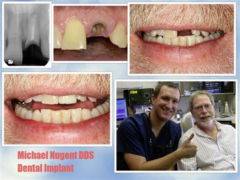 Dr Michael Nugent Dental Implant Dentist Pasadena Dentist