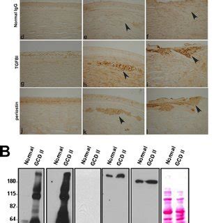 Periostin Is Expressed In Human Cornea A Schematic Representation Of