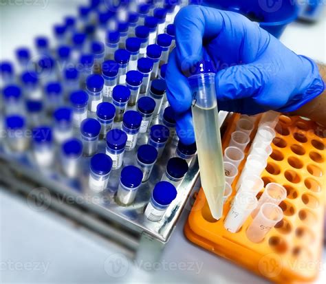 Technician Hold Urine Sample For Medical Analysis With Laboratory