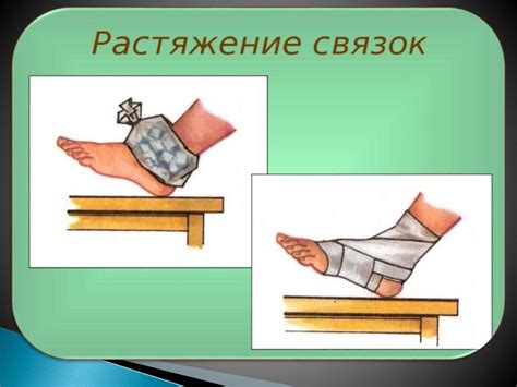Перелом. Помощь - презентация онлайн