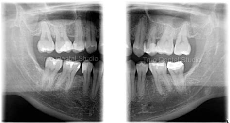 Dental X-Ray: Reliable & Caring Dentists