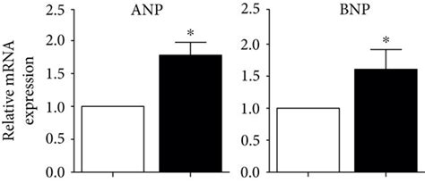 Resveratrol Alleviated Cardiac Dysfunction In DCM Mouse Heart A