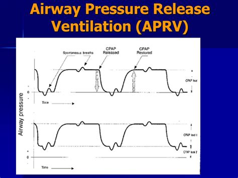 Ppt Airway Pressure Release Ventilation Aprv Powerpoint