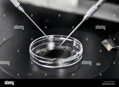 Proceso De La Fecundaci N In Vitro En El Laboratorio Fotograf A De