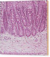 Lm Of A Section Through The Small Intestine Wall By Science Pictures