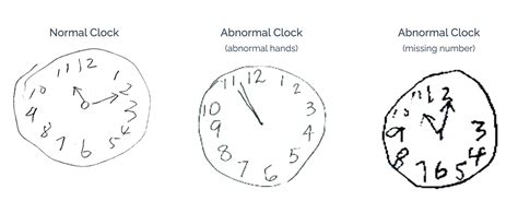 What Is A Clock Drawing Test At Susan Collier Blog