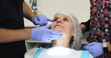 Rejuvenecimiento Facial Cl Nica Dental Y Est Tica Vi A Del Mar