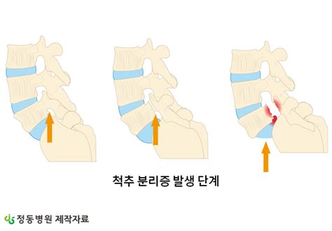 관절척추전문 정동병원