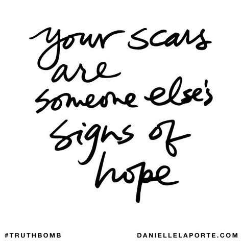 Quotes About Scars And Beauty