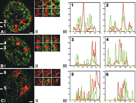 Spatial relationship between X-chromosome territories in primary female ...