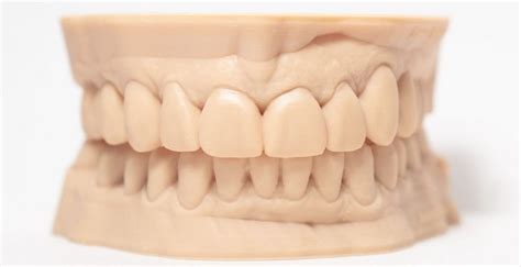 3d Printed Products Fusion Dental Lab