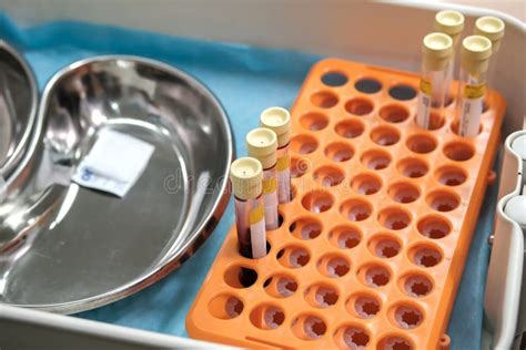 Tray with Blood Tube Samples in Hospital or Clinic Stock Photo - Image of medical, hematology ...