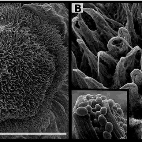 Electron Micrographs Of The C Tropicalis Myceliated Morphotype