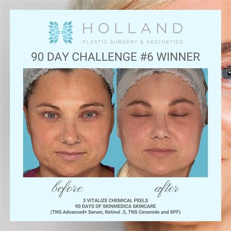 Holland Plastic Surgery And Aesthetics