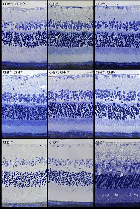 Loss Of Cfb Cfh Or Cfd Does Not Affect Retinal Morphology In One Year