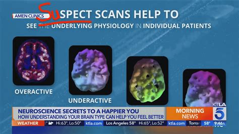 What do scientists think of Daniel Amen and his SPECT scan diagnoses ... 