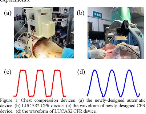 Figure 1 from High-Quality Chest Compression for Cardiopulmonary ...