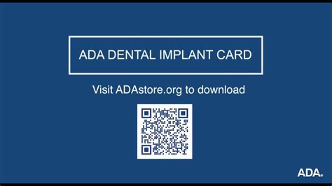 Ada Dental Implant Card Youtube