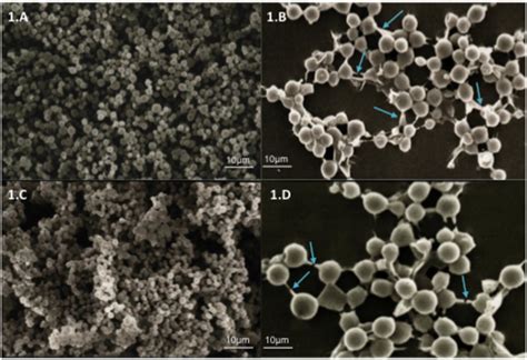 Scanning electron microscopy (SEM) showing yeast communities adhered to ... 