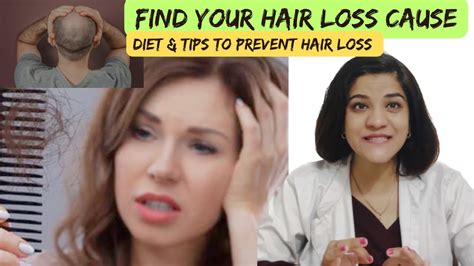 What Are The Reasons Of Hair Loss Diet In Hair Loss Hairloss