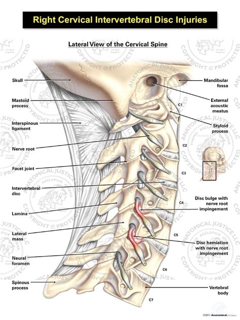 Cervical Intervertebral Disc