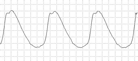 InjectorService.com.ua • Датчик разрежения