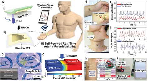 Self‐powered Wearable Piezoelectric Monitoring Of Human Motion And