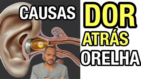 Dor Na Orelha Por Fora