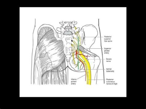 Sacral Plexus Block