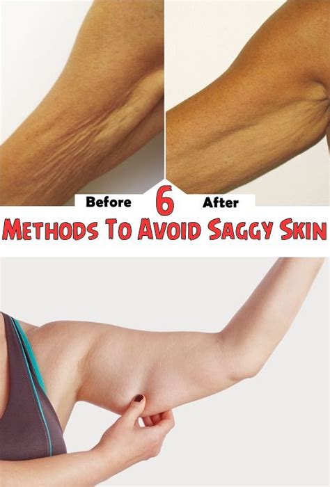 6 Methods To Avoid Saggy Skin Markus Fitness Saggy Skin Health And