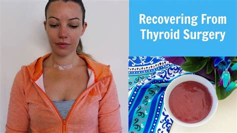 DIAGRAM Diagram Of Thyroid Surgery FULL Version HD Quality Thyroid