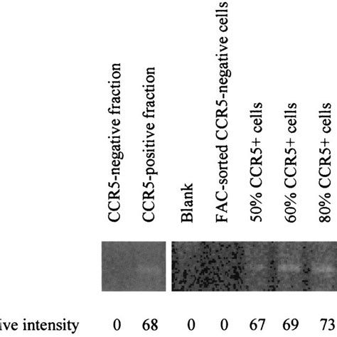 Representative Ccr Rna Analysis By Rt Pcr Showing The Purity Of The