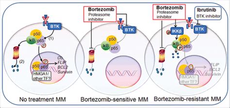 Full Article Ibrutinib Brute Force Against Bortezomib Resistant