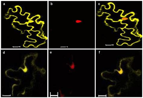 Subcellular Localization Of CLCuKV Dab CP Fusion Protein In