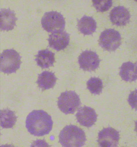 Babesia Canis Within Red Blood Cell In Giemsa Stained Blood Smear Of A