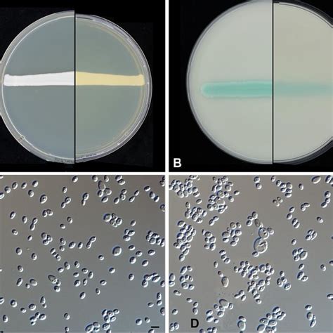 The First Cases Of Candida Auris Candidemia In Oman Request PDF