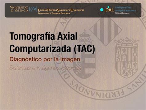 Pdf Tomograf A Axial Computarizada Tac Uv Pdf Filetomograf A