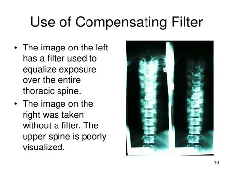 Ppt X Ray Filtration Powerpoint Presentation Free Download Id1752246