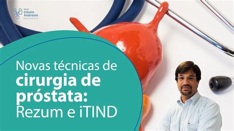 Novas T Cnicas De Cirurgia De Pr Stata Rezum E Itind Dr Cassio