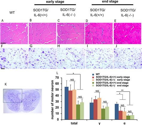 Histological Analysis Of Motor Neuron Loss And Muscle Atrophy In Als