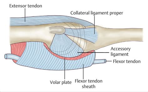 62 Finger (PIP/DIP) Collateral Ligament Repair | Plastic Surgery Key