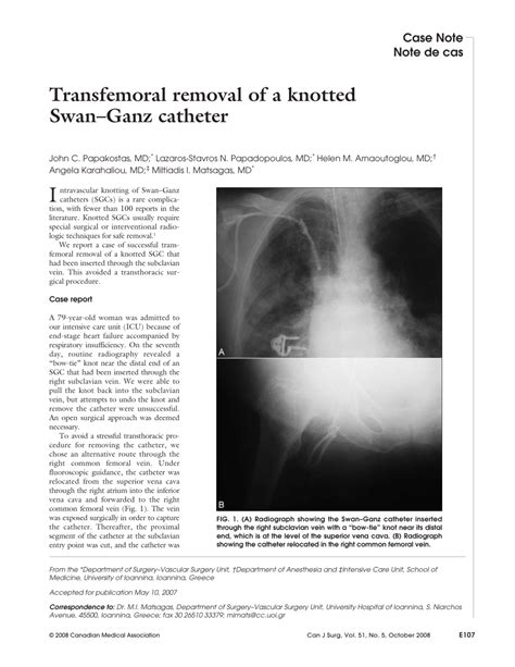 (PDF) Transfemoral removal of a knotted Swan-Ganz catheter