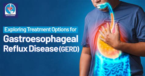 Gastroesophageal Reflux Disease (GERD) : Exploring Treatment Options